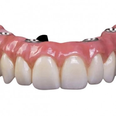 Prótese Protocolo em Moinhos de Vento