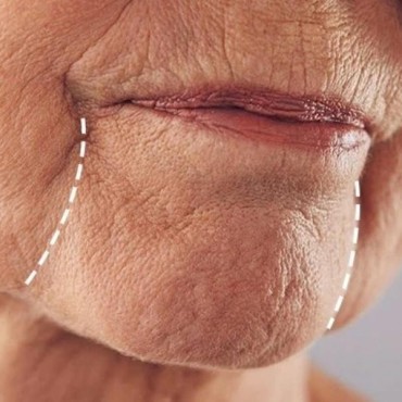 Preenchimento de Marionete em Porto Alegre em Moinhos de Vento