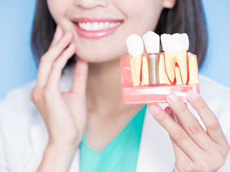 Implantes Dentários em Porto Alegre