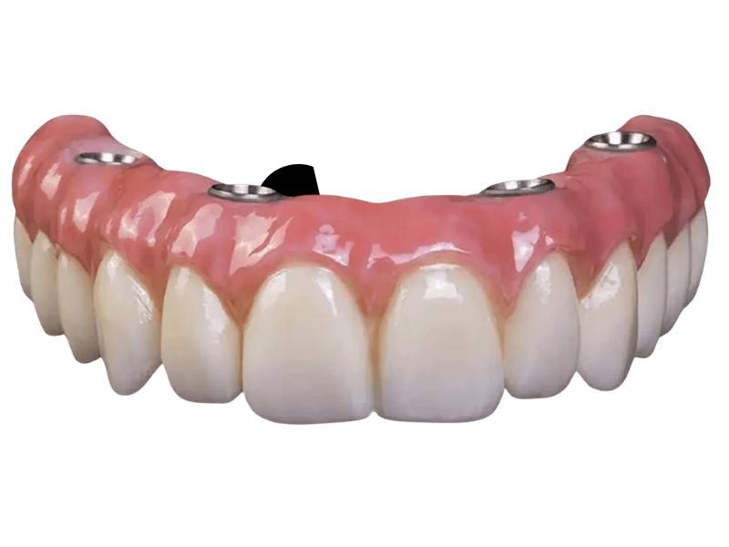 Prótese Protocolo em Porto Alegre