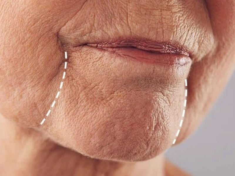 Preenchimento de Marionete em Porto Alegre em Moinhos de Vento