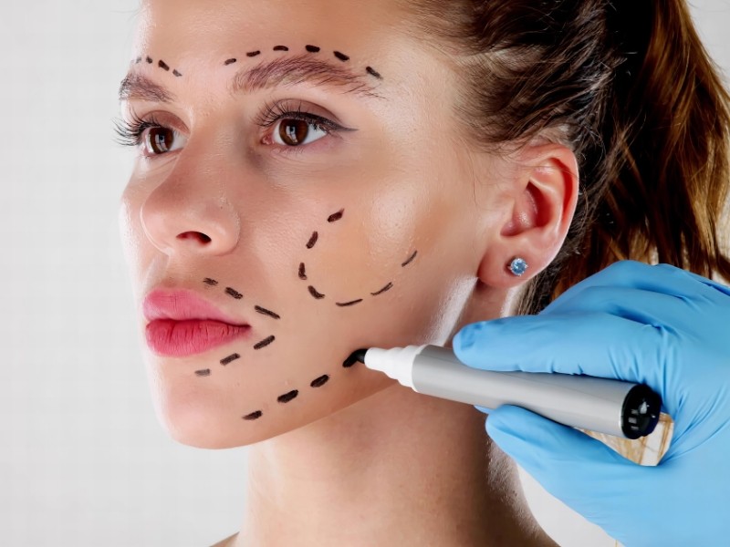 Preenchimento Facial